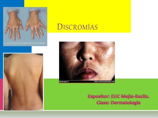 discromias cutaneas